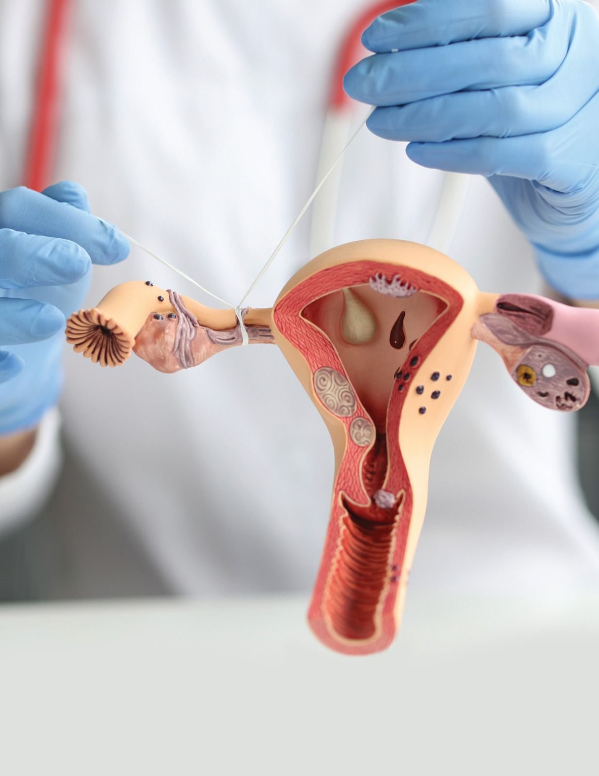 GOBIERNO ESTATAL APOYA  CON MÉTODOS ANTICONCEPTIVOS GRATUITOS