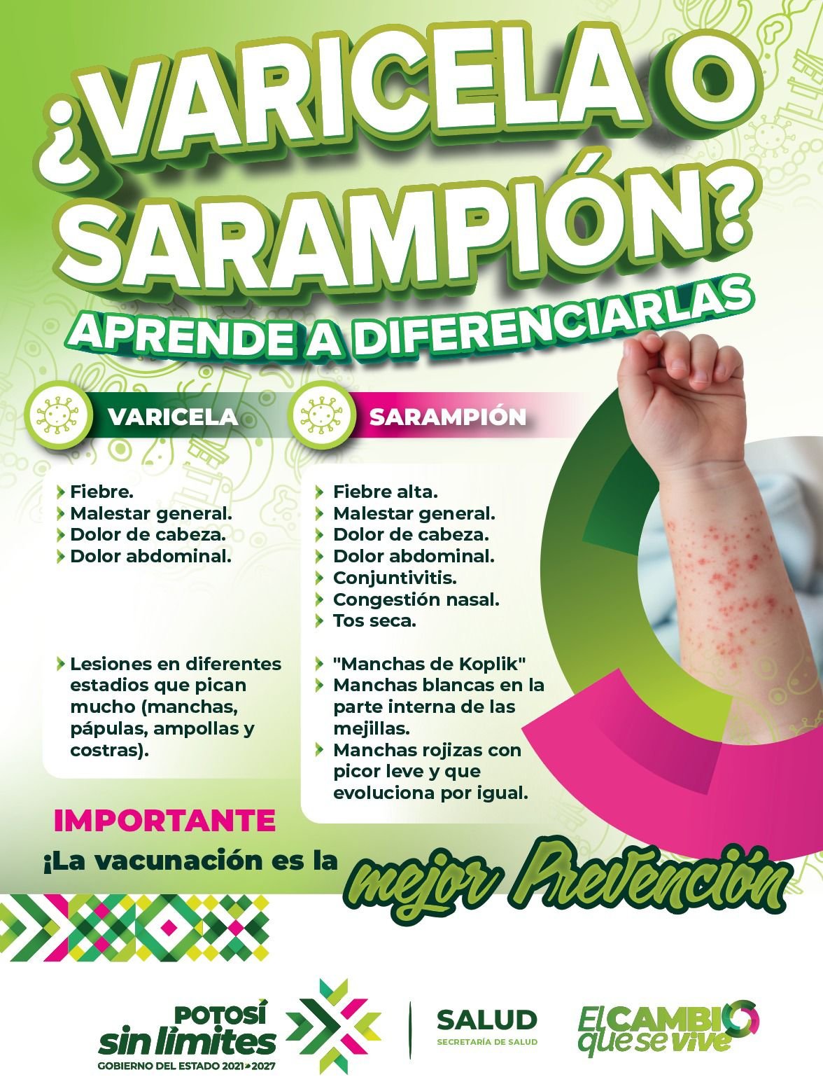 GOBIERNO DEL ESTADO REFUERZA CAMPAÑA INFORMATIVA SOBRE SARAMPIÓN Y VIRUELA