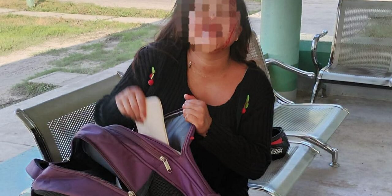 EN ESTADO DE EBRIEDAD Y SIN CASCO,  JOVEN SUFRE ACCIDENTE EN MOTOCICLETA